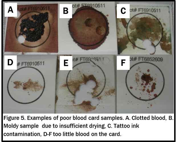 Figure 5. Examples of poor blood card samples.